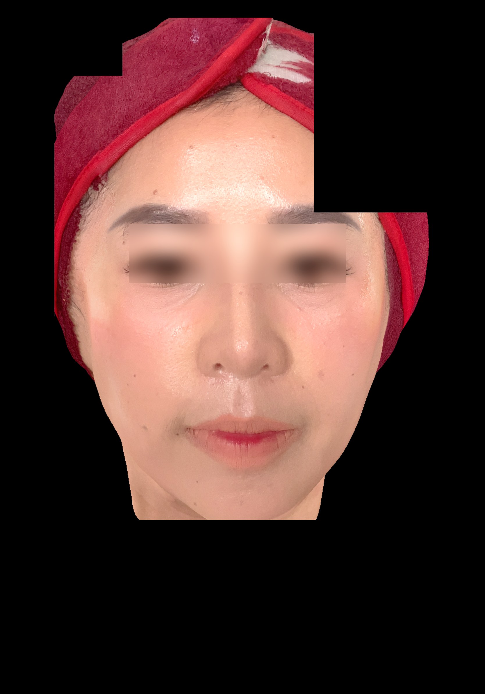 Sesudah