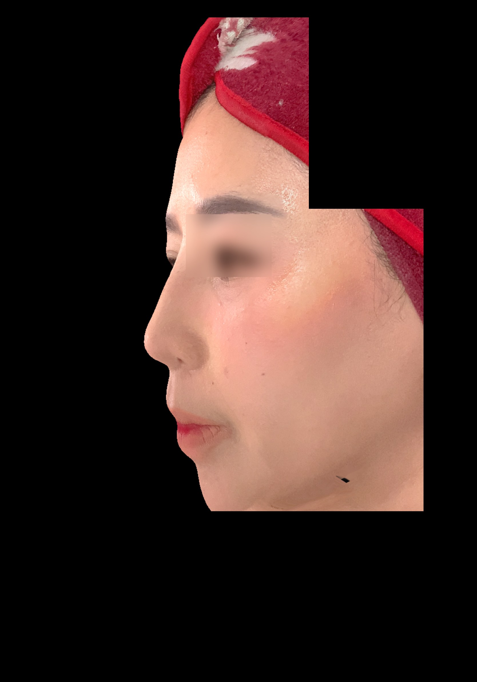 Sesudah