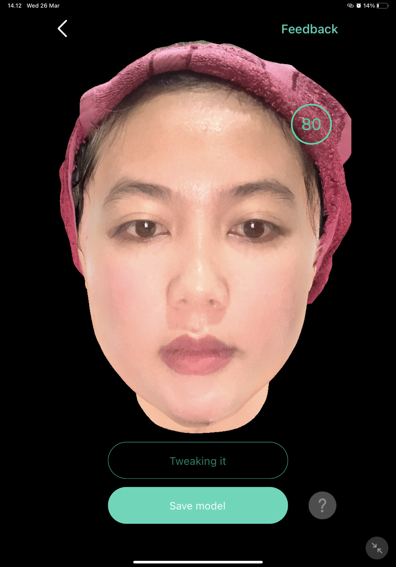 After — Meso Pipi V-Shape