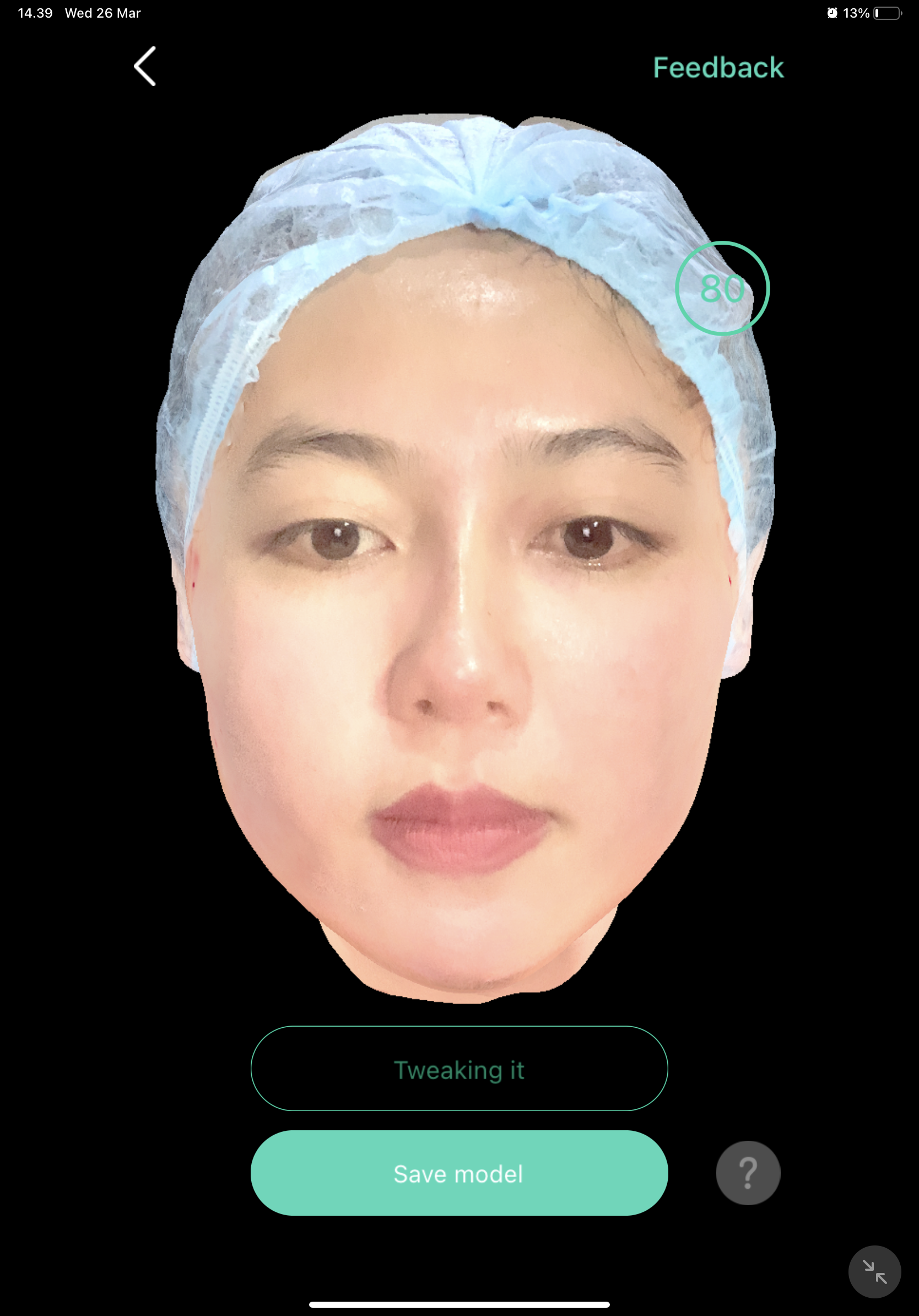 Before — Meso Pipi V-Shape