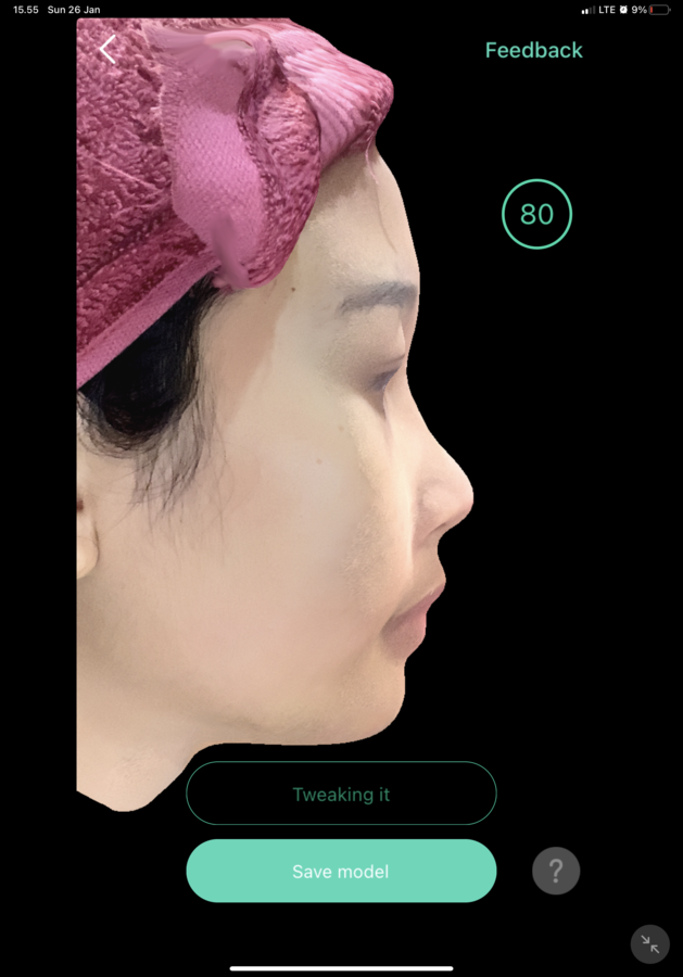 Before — Threadlift Hidung